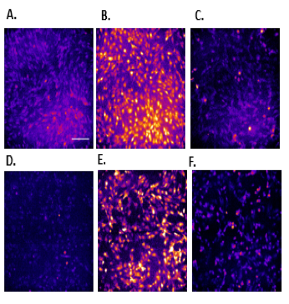 Inhibition of Vascular Endothelial Cell Leak