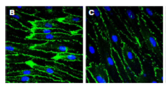 Inhibition of major integrin